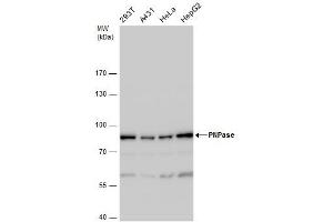 WB Image PNPase antibody detects PNPase protein by western blot analysis. (PNPT1 抗体)