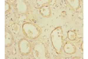 Immunohistochemistry of paraffin-embedded human kidney tissue using ABIN7163729 at dilution of 1:100 (POGK 抗体  (AA 101-400))