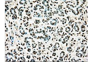 Immunohistochemical staining of paraffin-embedded breast tissue using anti-TYRO3 mouse monoclonal antibody. (TYRO3 抗体)