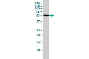 SARS monoclonal antibody (M01), clone 1H4 Western Blot analysis of SARS expression in Jurkat . (Seryl-tRNA Synthetase (SARS) (AA 1-514) 抗体)