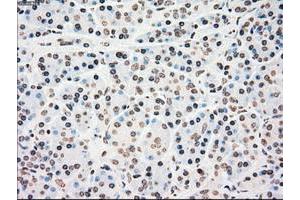 Image no. 7 for anti-Checkpoint Kinase 2 (CHEK2) antibody (ABIN1497496)