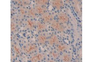 Used in DAB staining on fromalin fixed paraffin- embedded Kidney tissue (Metaxin 1 抗体  (AA 70-203))