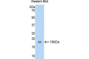 Western blot analysis of the recombinant protein. (LAMa4 抗体  (AA 102-234))