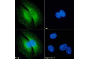 Immunofluorescence staining of fixed HeLa cells with anti-RAP antibody 7F1. (Recombinant LRPAP1 抗体)
