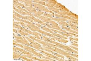 Immunohistochemistry of paraffin embedded rat heart using Igfn1 (ABIN7074278) at dilution of 1:700 (400x lens) (IGFN1 抗体)