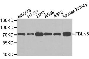 Western blot analysis of extracts of various cell lines, using FBLN5 antibody. (Fibulin 5 抗体)