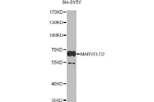 Western blot analysis of extracts of SH-SY5Y cells, using MARVELD2 antibody. (Tricellulin 抗体)