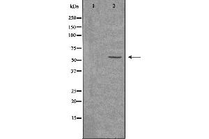 Western blot analysis of extracts from K562 cells, using ACVL1 antibody.