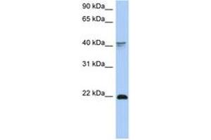 Image no. 1 for anti-Distal-Less Homeobox 4 (DLX4) (C-Term) antibody (ABIN6742745) (DLX4 抗体  (C-Term))