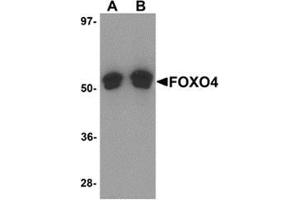 Western blot analysis of FOXO4 in A-20 cell lysate with FOXO4 antibody at (A) 0. (FOXO4 抗体  (N-Term))