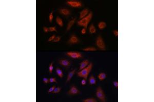 Immunofluorescence analysis of A-549 cells using RSPO1 Rabbit pAb (ABIN6132958, ABIN6147279, ABIN6147280 and ABIN6224304) at dilution of 1:100 (40x lens).