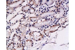 Formalin-fixed and paraffin embedded: rat kidney tissue labeled with Anti-ET-1 Polyclonal Antibody , Unconjugated at 1:200, followed by conjugation to the secondary antibody and DAB staining (Prepro-Endothelin-1 (AA 16-110) 抗体)