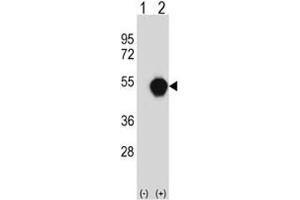 Western blot analysis of PXK antibody and 293 cell lysate (2 ug/lane) either nontransfected (Lane 1) or transiently transfected (2) with the PXK gene. (PXK 抗体  (AA 221-251))