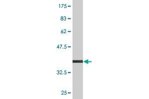 Western Blotting (WB) image for anti-Interleukin 1 Receptor, Type II (IL1R2) (AA 21-120) antibody (ABIN521669)
