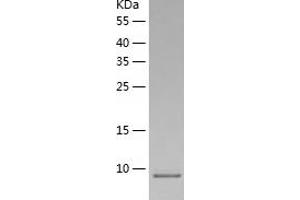Western Blotting (WB) image for S100 Calcium Binding Protein A7 (S100A7) (AA 1-101) protein (His-IF2DI Tag) (ABIN7124963)