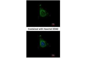 ICC/IF Image Immunofluorescence analysis of methanol-fixed HeLa, using AKAP10, antibody at 1:500 dilution. (AKAP10 抗体  (C-Term))