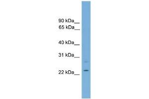 WB Suggested Anti-RBM11 Antibody Titration:  0. (RBM11 抗体  (Middle Region))