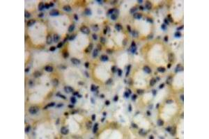 IHC-P analysis of Kidney tissue, with DAB staining. (COL4a3 抗体  (AA 1428-1670))