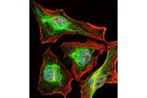 Image no. 1 for anti-BPI Fold Containing Family B, Member 1 (BPIFB1) (AA 248-475) antibody (ABIN1502165) (BPIFB1 抗体  (AA 248-475))