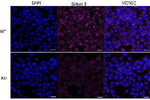 Immunocytochemical staining of HeLa cells using Sirtuin 3 antibody (ABIN7800354), 1:1,000), Top panel: wild-type (WT), Bottom panal: Sirtuin 3 shRNA knockdown (KD). (Recombinant SIRT3 抗体)