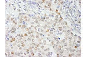 anti-General Transcription Factor IIIC, Polypeptide 4 (GTF3C4) (AA 625-675) antibody