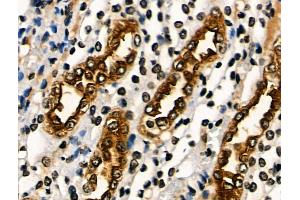 ABIN6265563 and ABIN6266644 at 1/100 staining Rat kidney tissue by IHC-P.