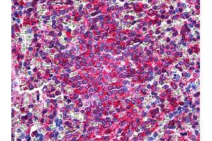 Anti-L Plastin antibody IHC of human spleen. (LCP1 抗体  (Headpiece Region))