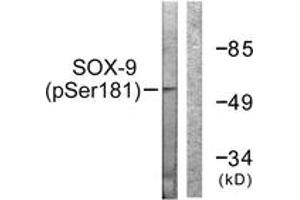 Western blot analysis of extracts from 293 cells treated with PBS 60', using SOX-9 (Phospho-Ser181) Antibody. (SOX9 抗体  (pSer181))
