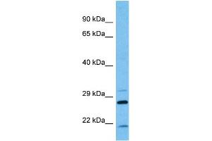 Host:  Mouse  Target Name:  KCNIP2  Sample Tissue:  Mouse Pancreas  Antibody Dilution:  1ug/ml (KCNIP2 抗体  (N-Term))