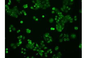 Image no. 7 for anti-Signal Transducer and Activator of Transcription 1, 91kDa (STAT1) antibody (ABIN1501169)