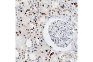 Immunohistochemical staining (Formalin-fixed paraffin-embedded sections) of human kidney with HNF1B monoclonal antibody, clone CL0374  shows moderate to strong nuclear immunoreactivity in renal tubules. (HNF1B 抗体)