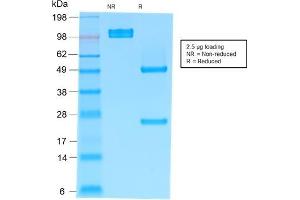 SDS-PAGE Analysis Purified IgM Mouse Recombinant Monoclonal Antibody (rIM373). (Recombinant IGHM 抗体)