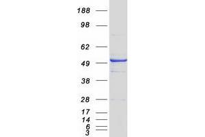 Western Blotting (WB) image for Cytochrome P450, Family 7, Subfamily A, Polypeptide 1 (CYP7A1) protein (Myc-DYKDDDDK Tag) (ABIN2712786)