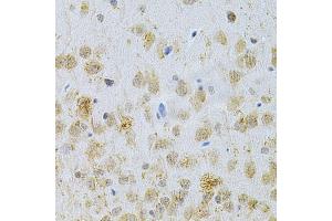Immunohistochemistry of paraffin-embedded rat brain using MAP2 Antibody (ABIN1873602) at dilution of 1:200 (40x lens). (MAP2 抗体)