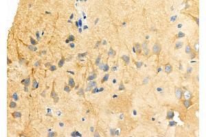 ABIN6263094 and ABIN6273266 at 1/100 staining Rat brain tissue by IHC-P.