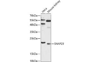 Western blot analysis of extracts of various cell lines, using SN antibody (ABIN7270670) at 1:1000 dilution. (SNAP23 抗体  (AA 1-211))