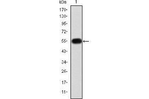 Western blot analysis using MMP9 mAb against human MMP9 (AA: 238-465) recombinant protein. (MMP 9 抗体)