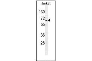 Western blot analysis of RBM14 Antibody (C-term) in Jurkat cell line lysates (35ug/lane). (RBM14 抗体  (C-Term))