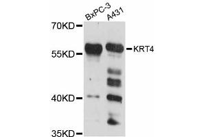 Western blot analysis of extracts of various cell lines, using KRT4 antibody (ABIN5998102) at 1:3000 dilution. (KRT4 抗体)