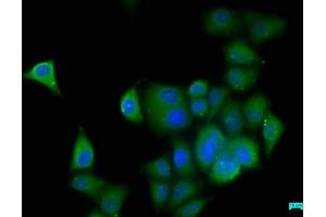 Immunofluorescence staining of Hela cells with ABIN7157186 at 1:50, counter-stained with DAPI. (KALRN 抗体  (AA 2410-2661))