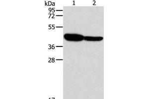 Western Blot analysis of Mouse brain and Human fetal brain tissue using GLRA1 Polyclonal Antibody at dilution of 1:500 (GLRA1 抗体)