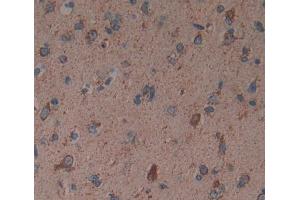 Used in DAB staining on fromalin fixed paraffin- embedded brain tissue (Reticulon 1 抗体  (AA 589-776))