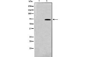 Western blot analysis on HT29 cell lysate using TAF5L Antibody,The lane on the left is treated with the antigen-specific peptide. (TAF5L 抗体  (Internal Region))