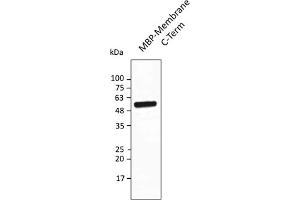 Western Blotting (WB) image for anti-SARS-CoV-2 Membrane Protein (SARS-CoV-2 M) (AA 150-215) antibody (ABIN7273018) (SARS-CoV-2 Membrane Protein 抗体  (AA 150-215))