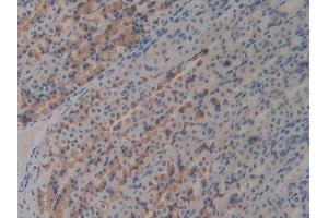 Immunohistochemistry (IHC) image for anti-Complement Component C7 (C7) (AA 1-144) antibody (ABIN7443419)
