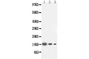 Anti-IL-4 antibody, Western blotting Lane 1: Recombinant Human IL-4 Protein 10ng Lane 2: Recombinant Human IL-4 Protein 5ng Lane 3: Recombinant Human IL-4 Protein 2. (IL-4 抗体  (Middle Region))