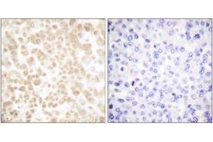 Immunohistochemistry (IHC) image for anti-FOS-Like Antigen 2 (FOSL2) (AA 271-320) antibody (ABIN2889199) (FOSL2 抗体  (AA 271-320))