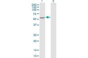 Western Blot analysis of GK2 expression in transfected 293T cell line by GK2 MaxPab polyclonal antibody. (GK2 抗体  (AA 1-553))