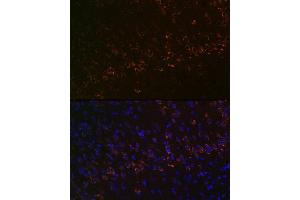 Immunofluorescence analysis of mouse brain using Huntingtin Rabbit mAb (ABIN7267793) at dilution of 1:100 (40x lens). (Huntingtin 抗体)