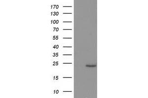 Western Blotting (WB) image for anti-Suppressor of Cytokine Signaling 3 (SOCS3) antibody (ABIN1501059) (SOCS3 抗体)